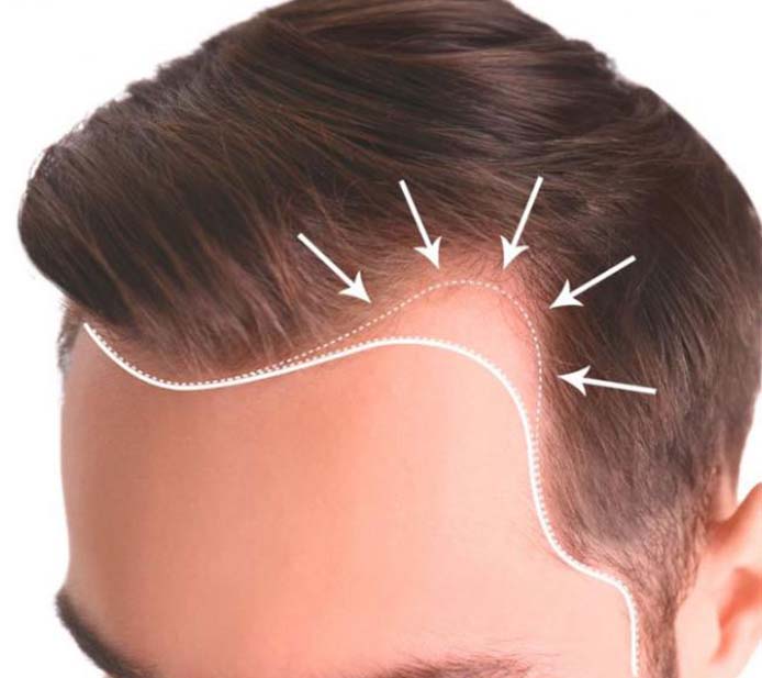 fue-sac-ekimi-1